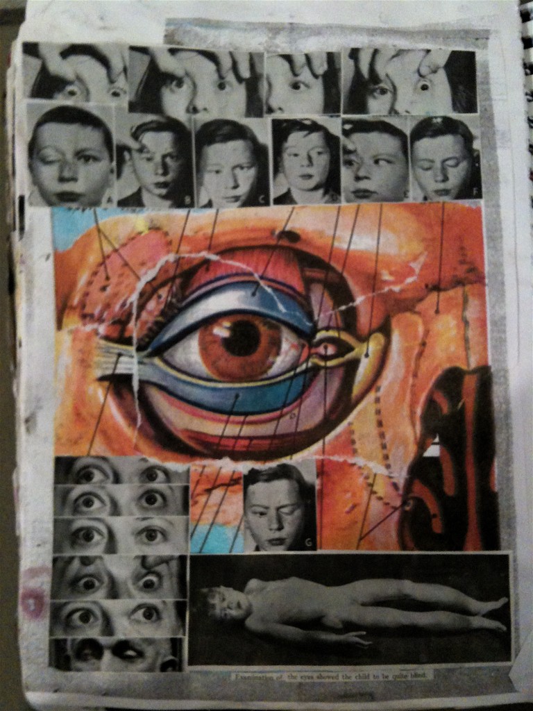 Eye